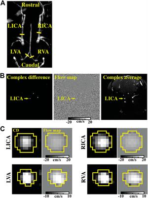 Toward accurate cerebral blood flow estimation in mice after accounting for anesthesia